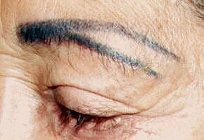 getImage (3)