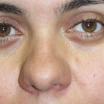 IMG_7155