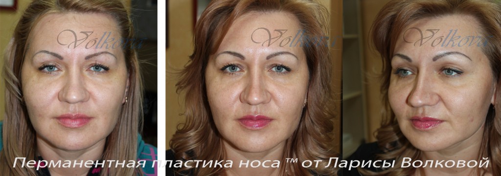 пп5