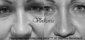 чб