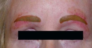 delat-li-tatuazh-4