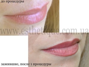 y_7aff071d