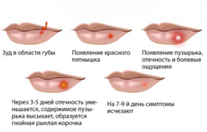1424465131_hejlit-11