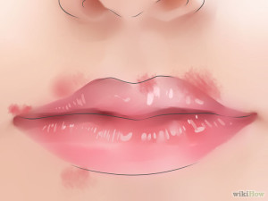 670px-Know-If-You-Have-Herpes-Step-3-Version-2