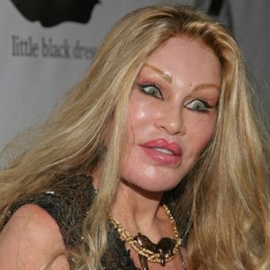 Jocelyn-Wildenstein-Cat-Woman-Plastic-Surgery-lip-injections-Before-and-After-Photos-Worst-Plastic-Surgery-photos-8