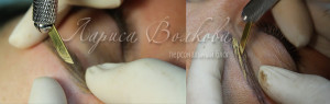 cover5