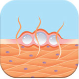 pic_blister