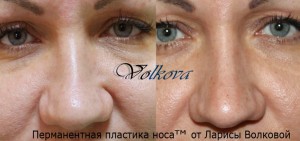 RgHgTRgRdN0
